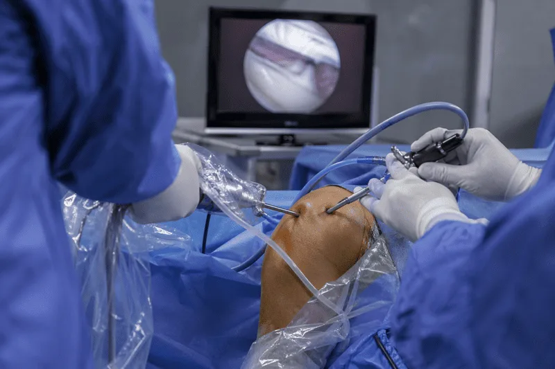 Artroscopia de hombro